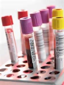 defense for dui blood tests
